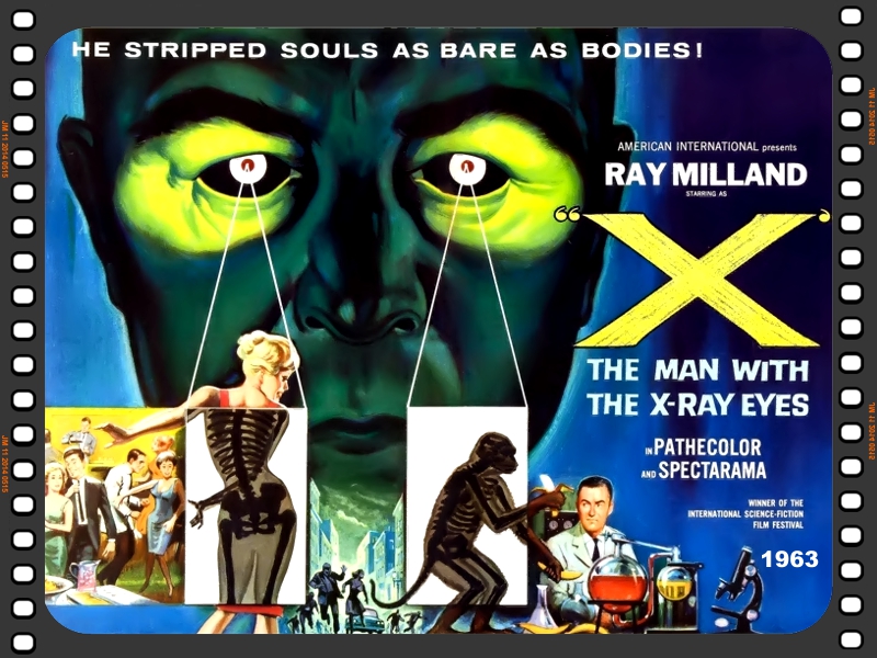 The Man with X-ray Eyes